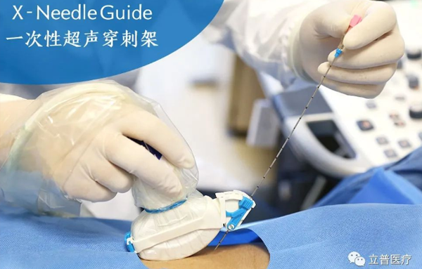 X-Needle Guide 一次性超声穿刺架3.0版本问世