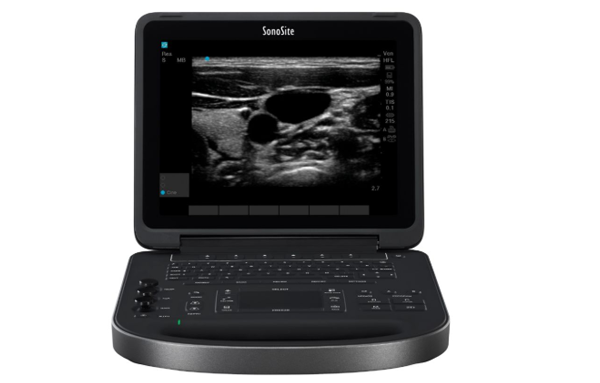 新型冠状病毒肺炎来袭，超声助力诊断！